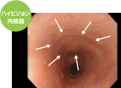 ハイビジョン内視鏡