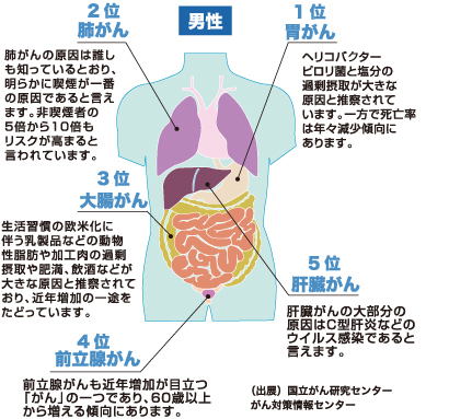 がんにかかる部位の図