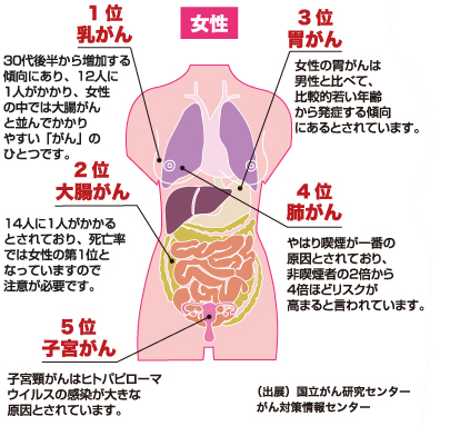 がんにかかる部位の図