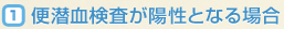 便潜血検査が陽性となる場合