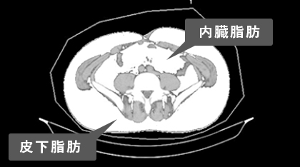 血液検査