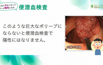 大きくなってやっと陽性になる「便潜血検査」