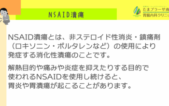 痛み止めを使いすぎていませんか？