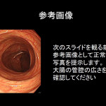 正常な大腸