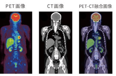 PET・CT画像