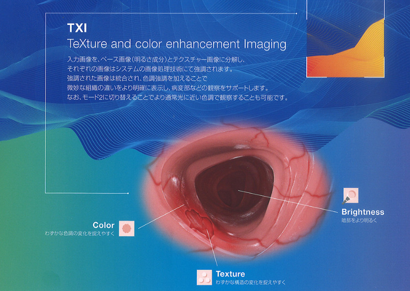 TXI(TeXture and color enhancement Imaging)