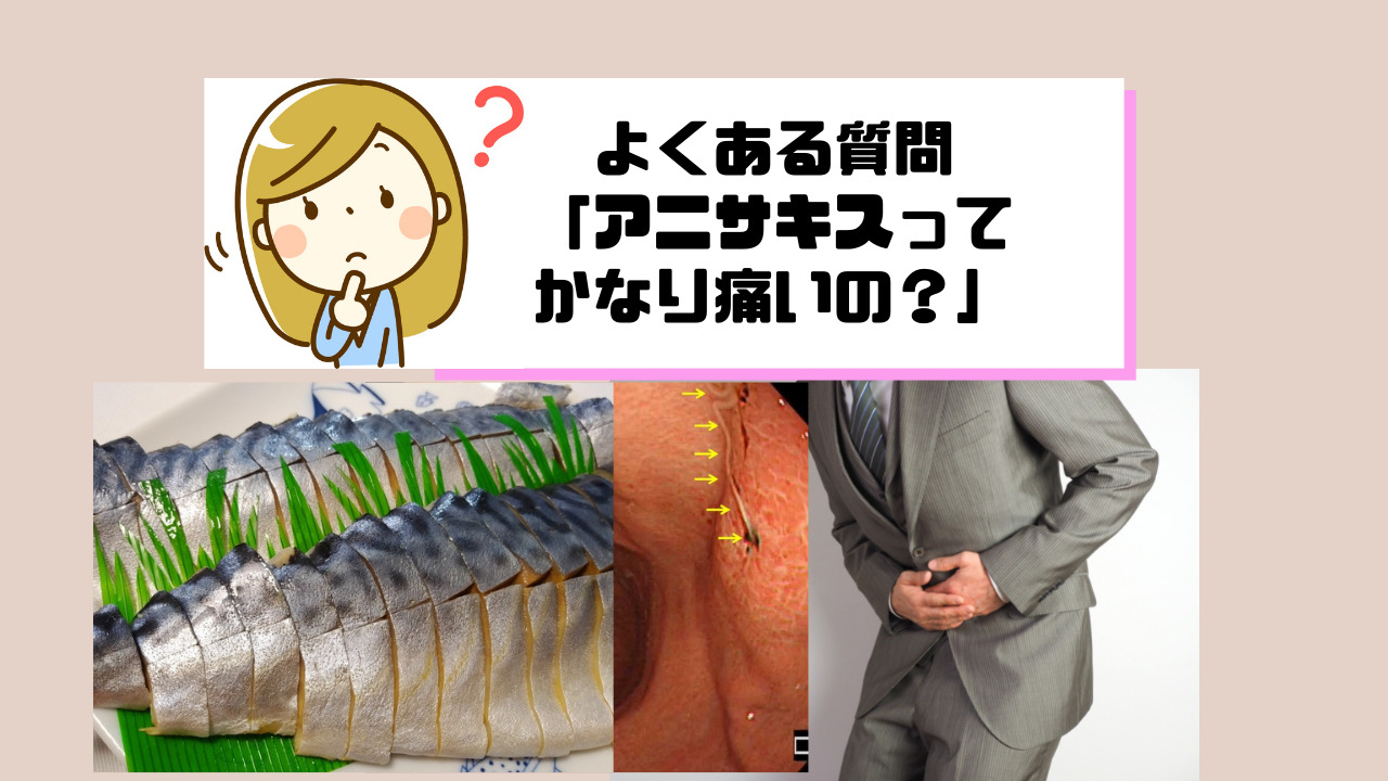 アニサキスにかかったら痛いですか？