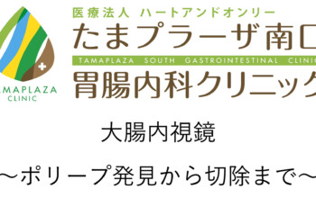 大腸ポリープ　発見、観察、切除まで