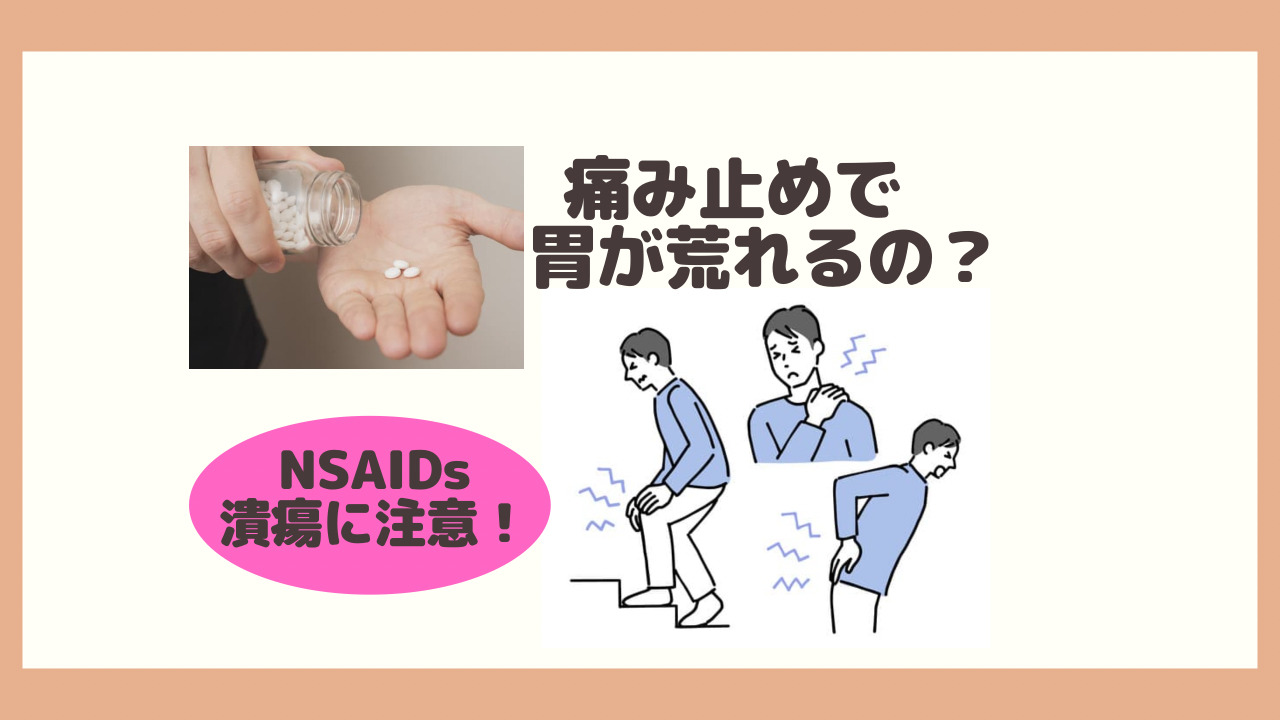 痛み止めで胃が荒れるの？ ｜たまプラーザ南口胃腸内科クリニック 消化器内視鏡横浜青葉区院