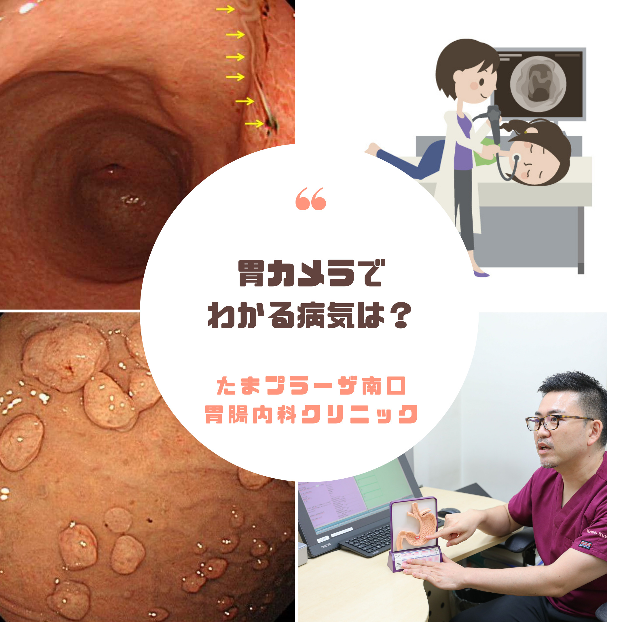 胃カメラで発見できる病気は？