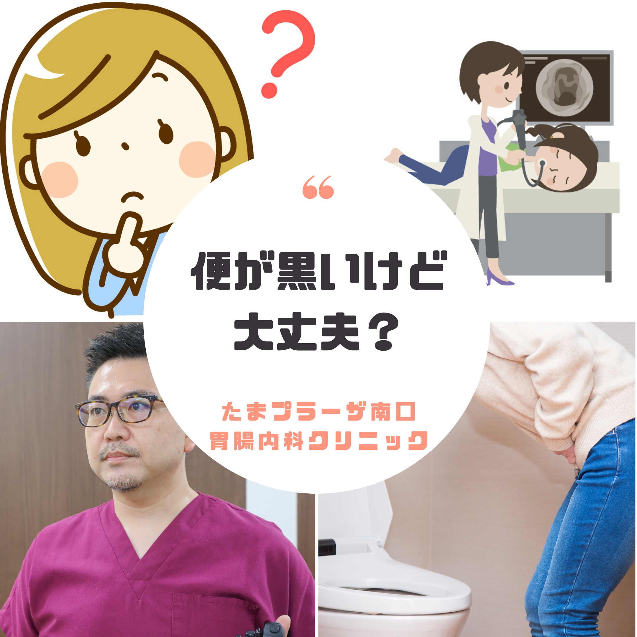 22+ 黒い 便 画像 10 便が黒いけど大丈夫ですか? |たまプラーザ南口胃腸内科クリニック 消化器内視鏡横浜青葉区院