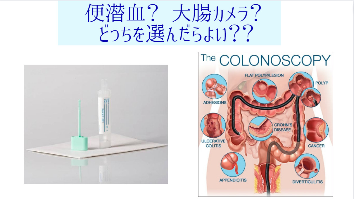 便潜血？ 大腸カメラ？ どちらを選んだらよい？？