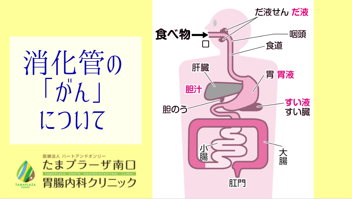 消化管の「がん」について