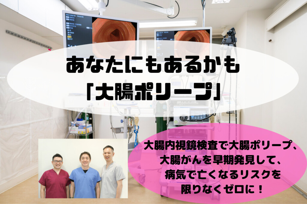 あなたにもあるかも「大腸ポリープ」