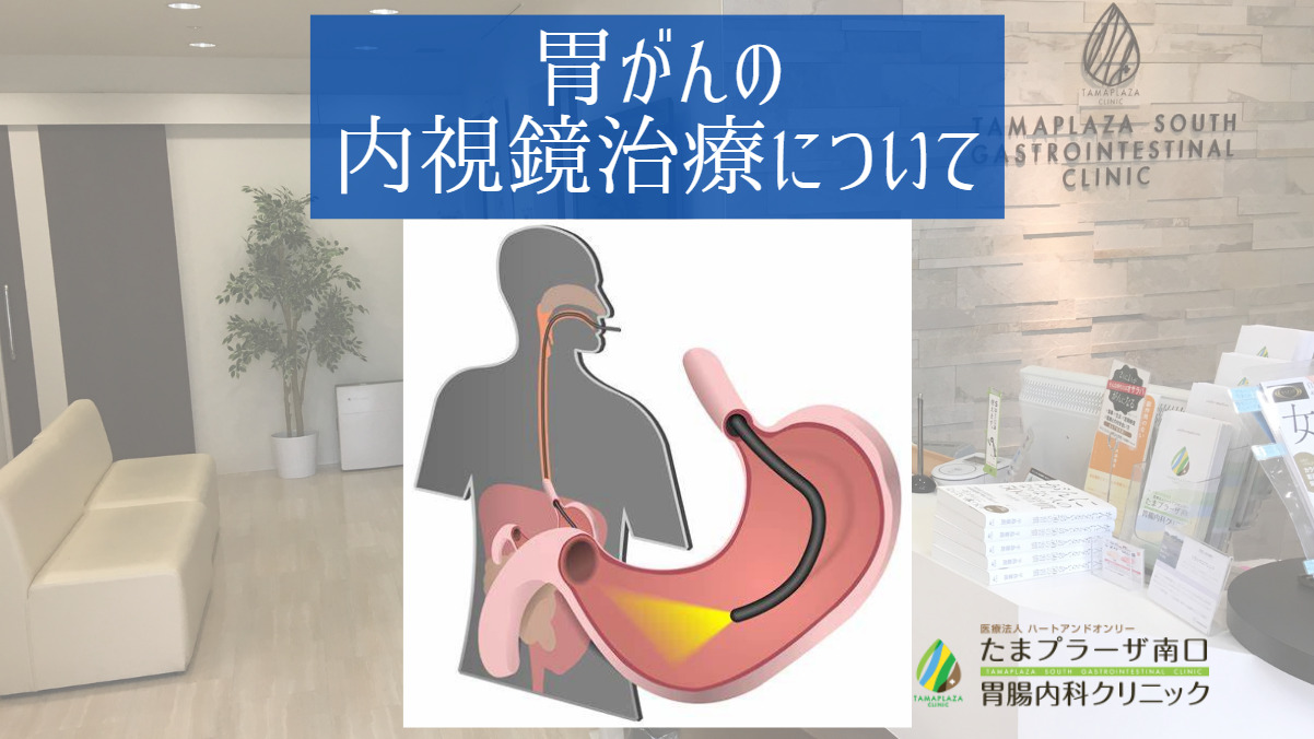 胃がんの内視鏡治療について |たまプラーザ南口胃腸内科クリニック 消化器内視鏡横浜青葉区院