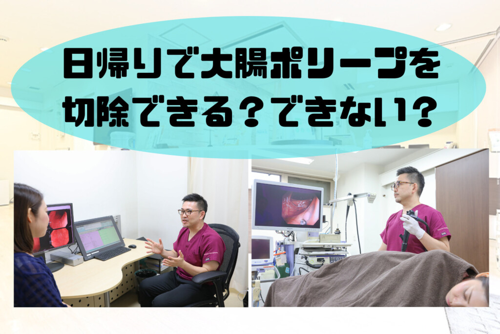 日帰りで大腸ポリープを切除できる？できない？