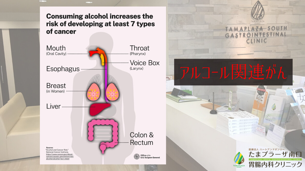 アルコール関連がん