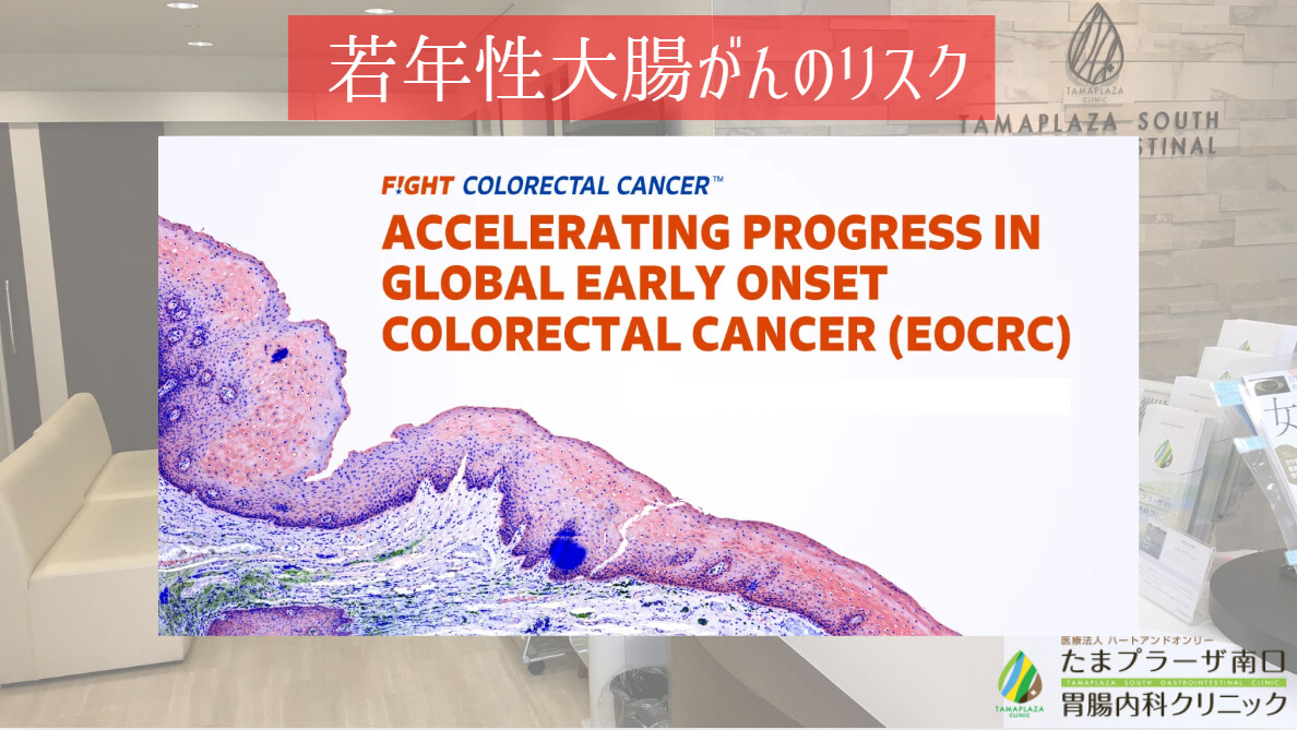 若年性大腸がんのリスク