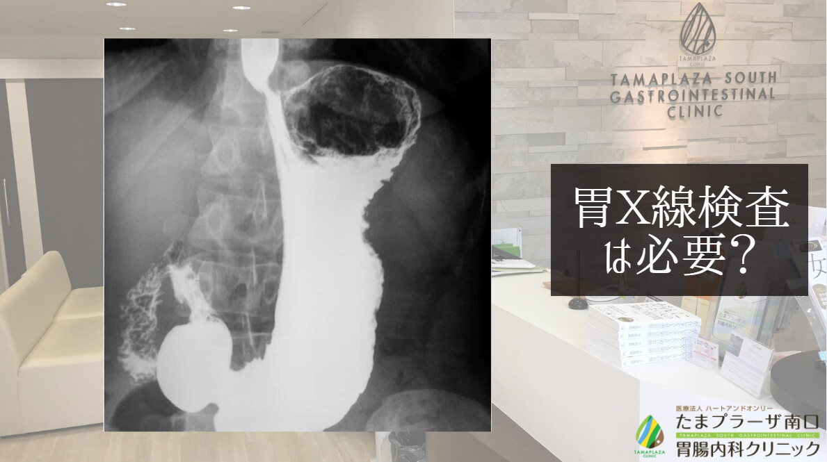 胃X線検査は必要？